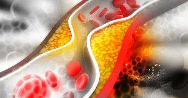 traitement anti cholesterol par la phytothérape