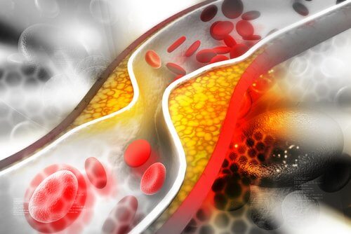 traitement anti cholesterol par la phytothérape